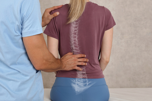 Physical therapist examining woman with scoliosis